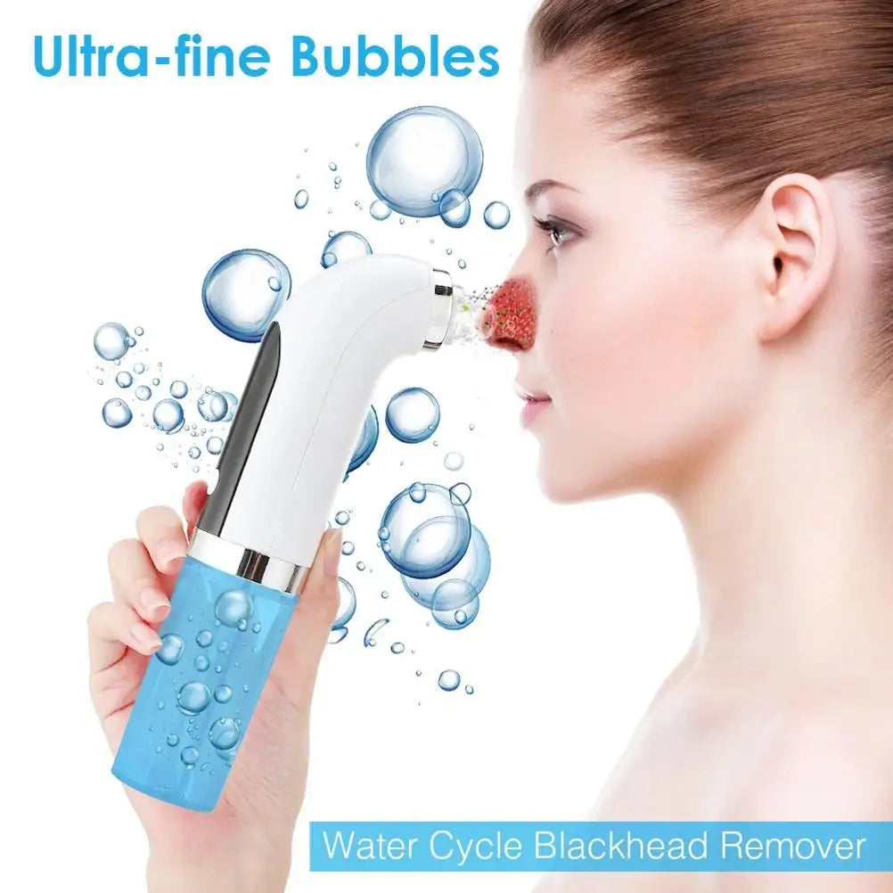 Electric Blackhead Vacuum Cleaner 6 Interchangeable Suction Tips Handheld ABS Blackhead Remover Pore Vacuum for Women for Home