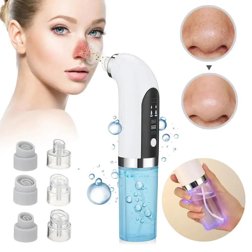 Electric Blackhead Vacuum Cleaner 6 Interchangeable Suction Tips Handheld ABS Blackhead Remover Pore Vacuum for Women for Home