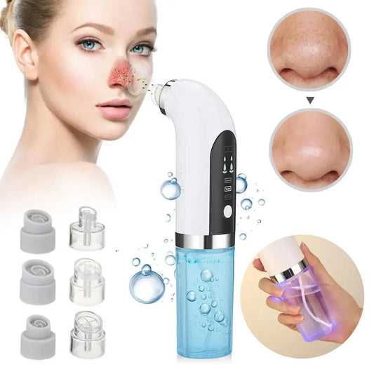 Electric Blackhead Vacuum Cleaner 6 Interchangeable Suction Tips Handheld ABS Blackhead Remover Pore Vacuum for Women for Home