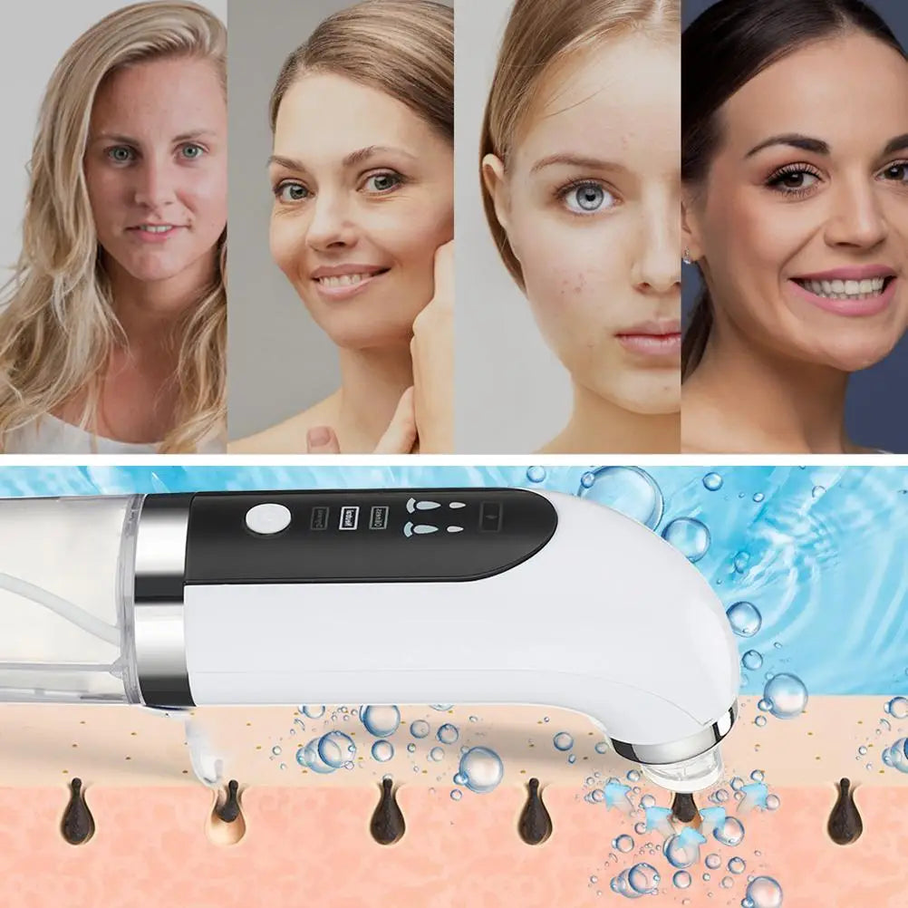 Electric Blackhead Vacuum Cleaner 6 Interchangeable Suction Tips Handheld ABS Blackhead Remover Pore Vacuum for Women for Home